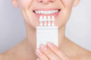 Tooth,Whitening,,Perfect,White,Teeth,Close,Up,With,Shade,Guide