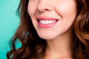 A close-up shot of a woman’s smile after getting porcelain veneers